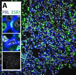 Lactotropas: la PRL en azul. ESR1= Receptor de Estrógenos en verde.