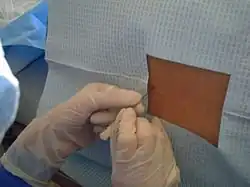 Punción lumbar en el adulto