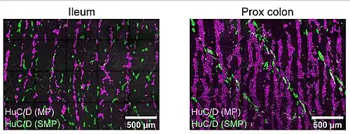 visualización simultánea de ambos Plexos en Ileon y en Colon proximal. MP= Plexo Mientérico SMP= Plexo SubMucoso (en verde). Inmunohistoquímica. Microscopía confocal.