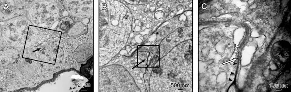 Especialización de membrana, se muestra la misma unión estrecha típica en dos magnificaciones. Puntas de flecha blancas= unión estrecha.