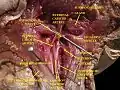 Muscles, arteries and nerves of neck.Newborn dissection.