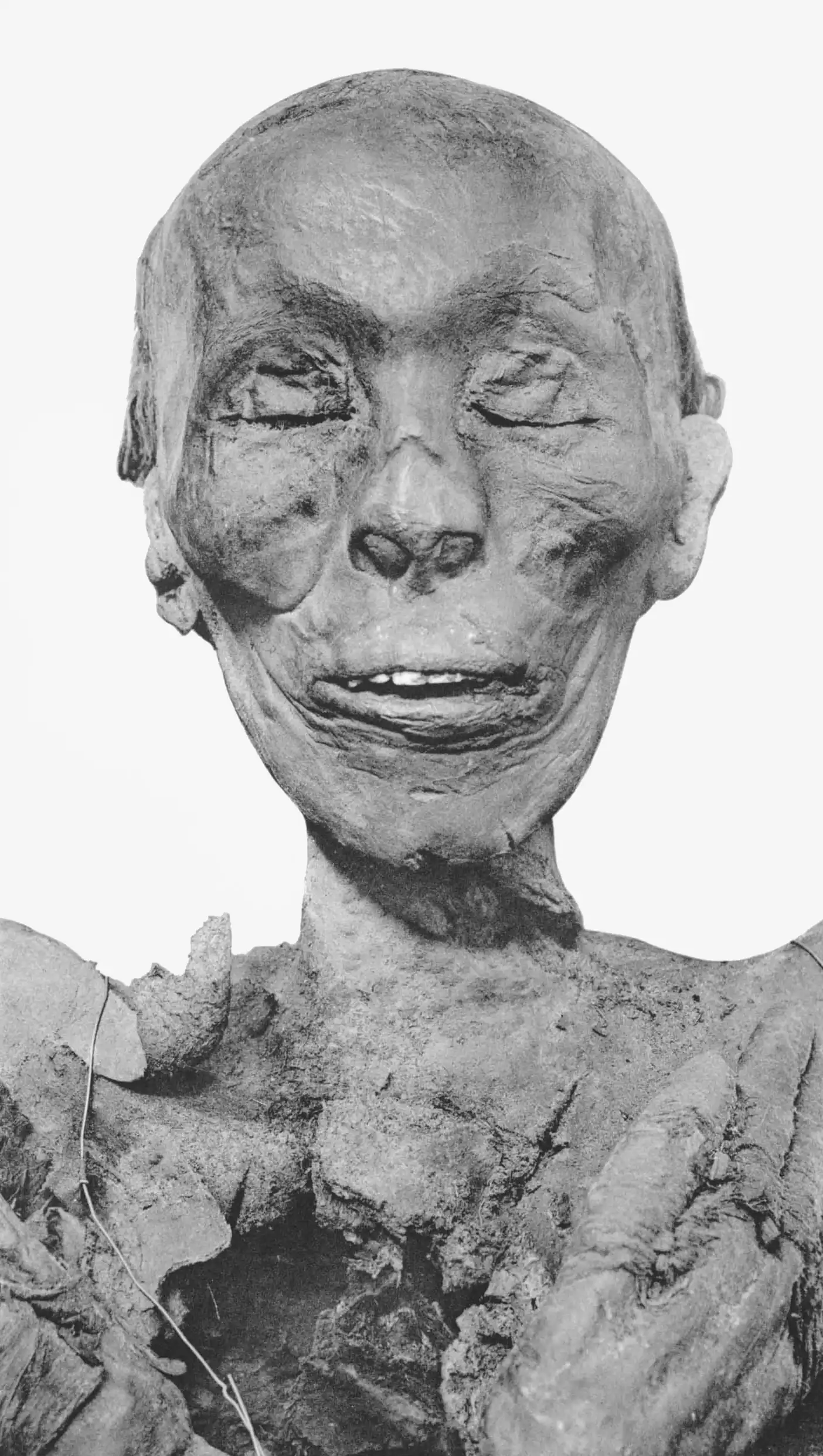 Thutmose_II_mummy_head