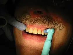 Pulimento dental.