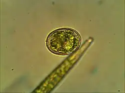 Quiste de Trachelomonas (Euglenozoa)