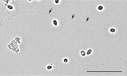 Tubo Polar extendido (flechas) ~140 μm. Brachiola algerae/Anncaliia algerae.