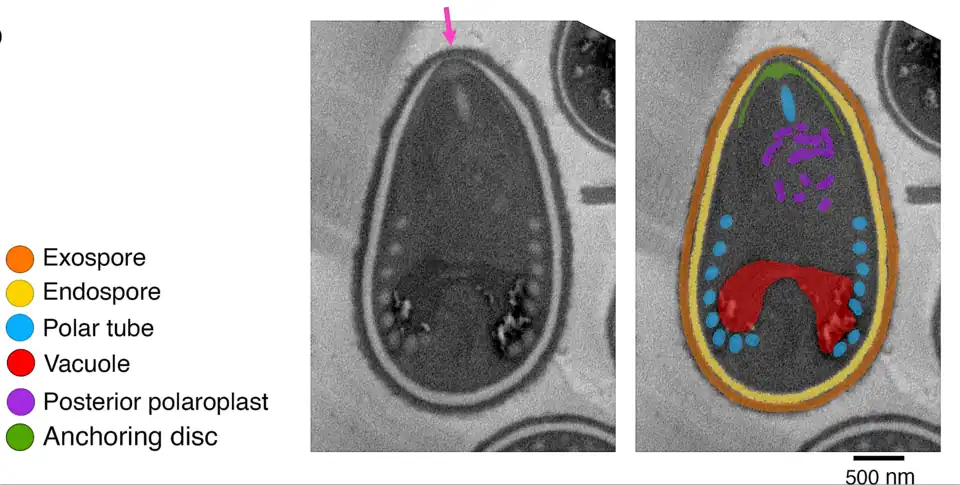 Filamento polar en azul, arriba centro: el segmento lineal, abajo lateral: espiral. Corte longitudinal de la espora. Microscopía electrónica.