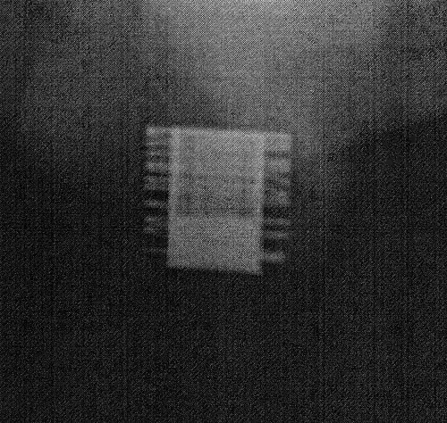 Una imagen de rayos X del ZSI 375 implantado. El dispositivo está activado: el resorte se descomprime en la parte superior del cilindro. El paciente es continente.