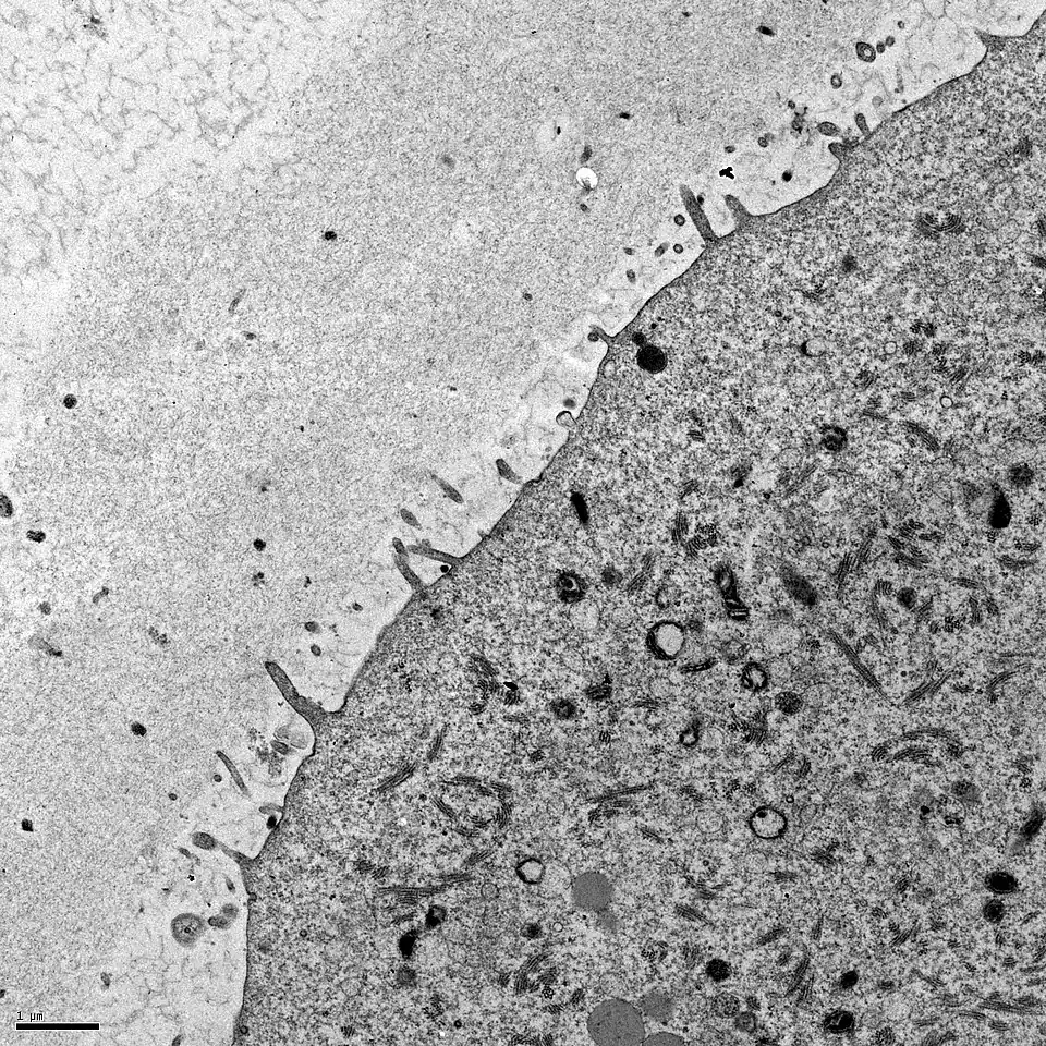 Zona pelúcida a la izquierda (en gris claro), penetrada por las microvellosidades con forma de dedo del ovocito. Ovocito a la derecha en gris oscuro. Microscopio electrónico de transmisión