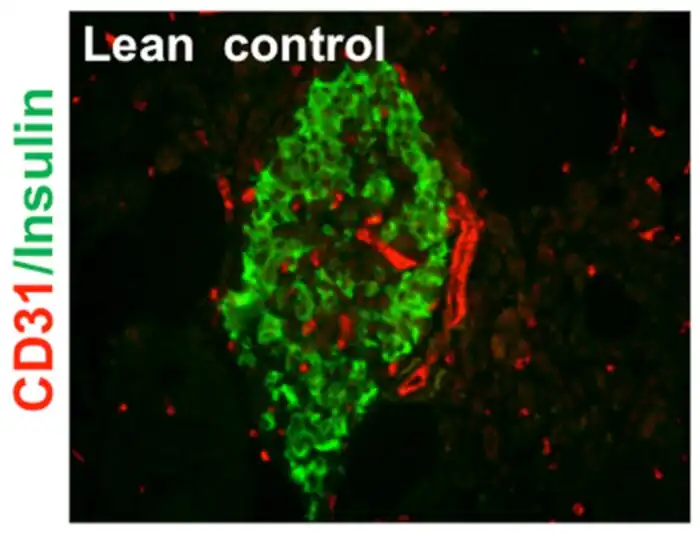 Arteriola y capilares de un islote pancreático. En la periferia (a la derecha en rojo), una arteriola seccionada horizontalmente, mostrando ambas paredes y la luz arteriolar. Capilares intra-islote seccionados de forma transversal. Las células endócrinas de insulina se ven en verde. Inmunohistoquímica y microscopio confocal.